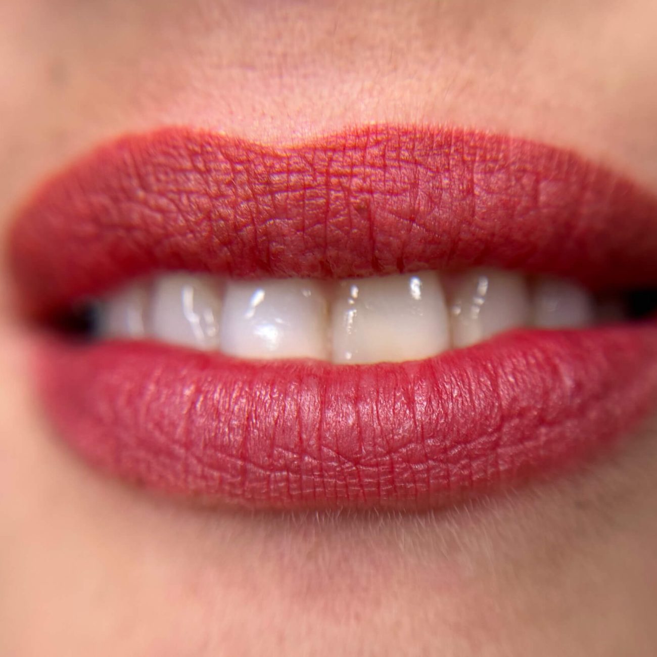 full lips